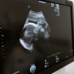 Schwangerschaftsanzeichen: Wann merkt man sie?